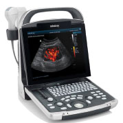 Digital Color Ultrasonogram